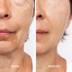 Serum Facial Antiarrugas con Bakuchiol, Aloe vera y 6 Aceites