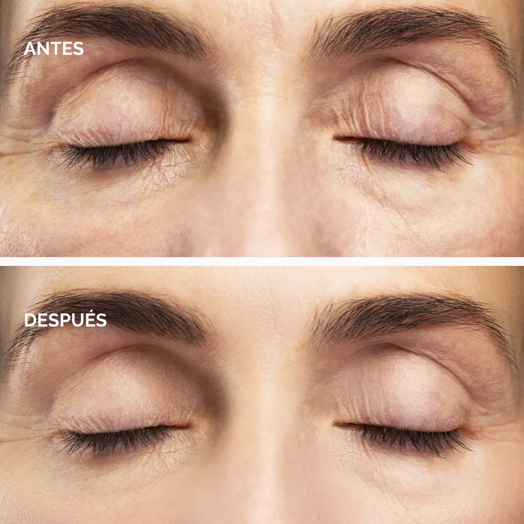 Contorno de Ojos (Aloe Vera + Jazmin + Cafeína + Espino Blanco)