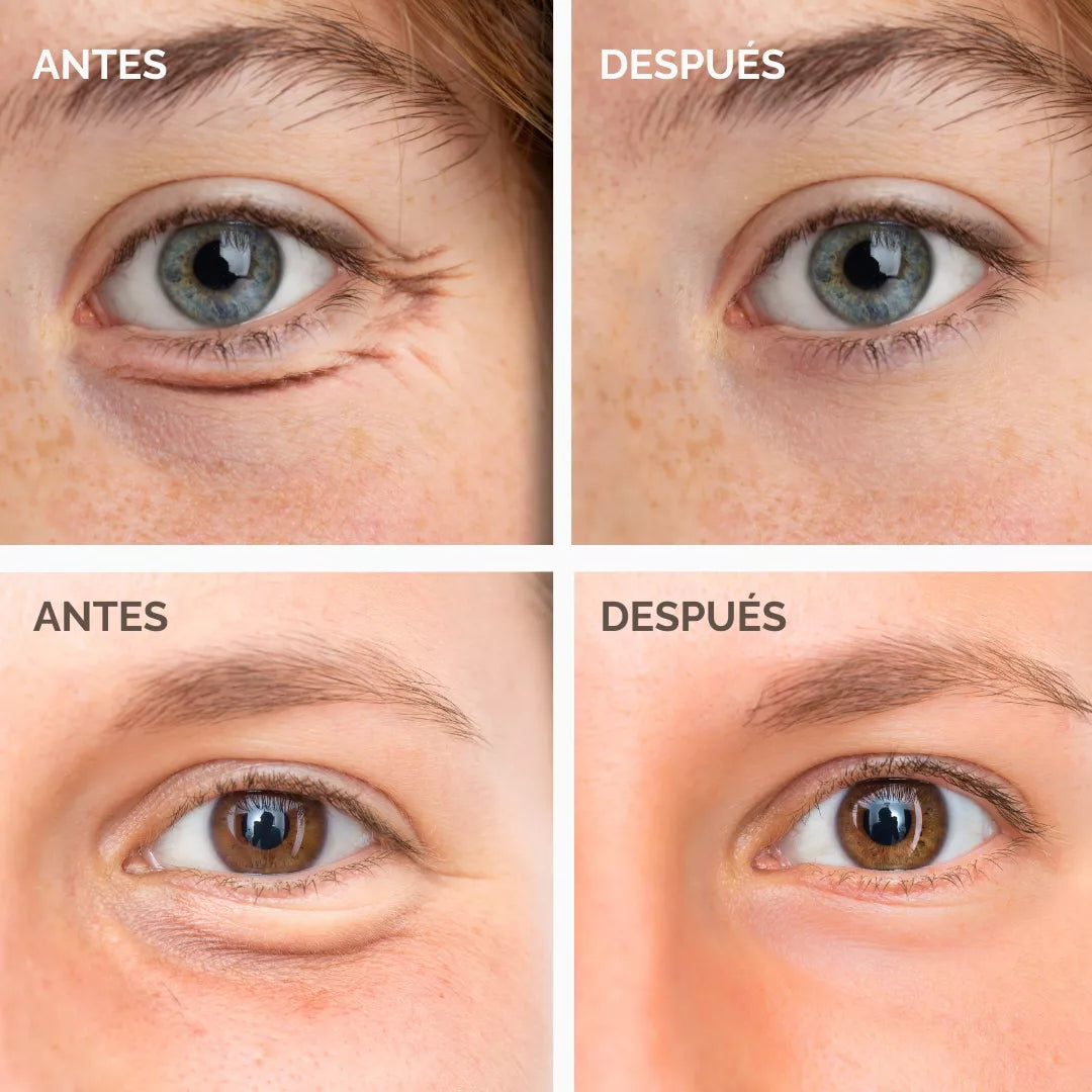 Contorno de Ojos (Aloe Vera + Jazmin + Cafeína + Espino Blanco)